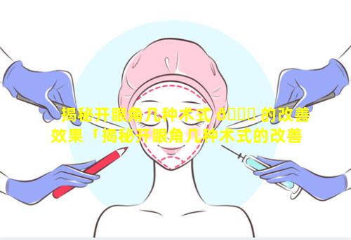 揭秘开眼角几种术式 🕊 的改善效果「揭秘开眼角几种术式的改善效果 🐴 是什么」